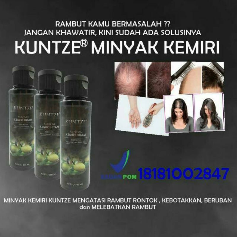 KUNTZE MINYAK KEMIRI HITAM ASLI 100%
