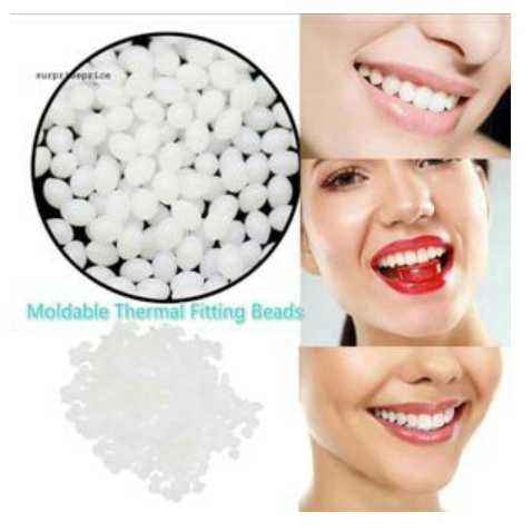 Temporary tooth repair / temptooth / gigi palsu buat sendiri /lem gigi padat