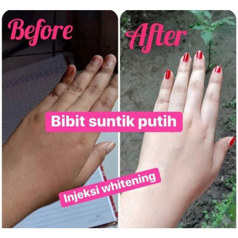 injeksi whitening kfs bibit pemutih badan
