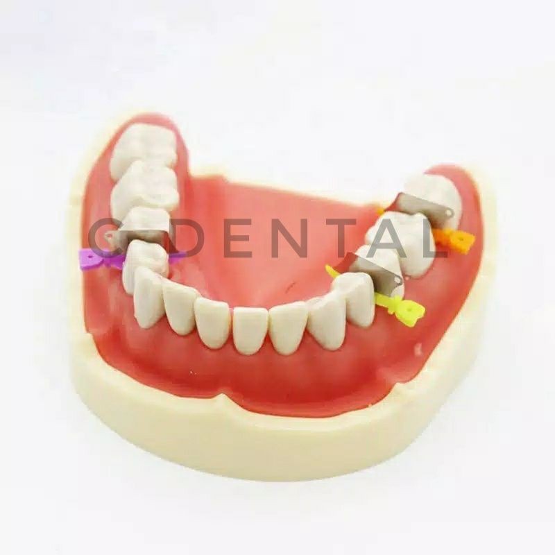 Dental Matrix&Wedge Proximal Flexible Gigi Anterior Posterior