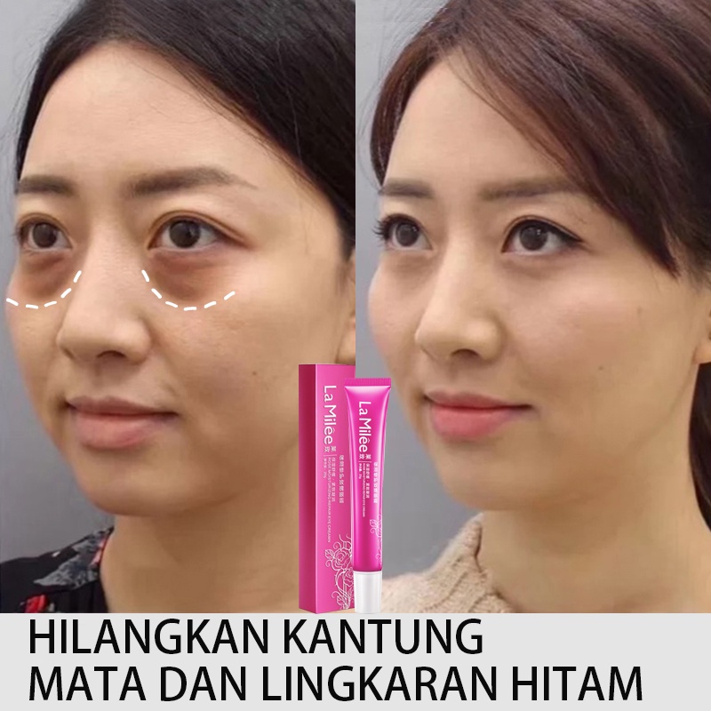 Eye Cream Eye Serum 20g Meringankan Lingkaran Hitam/Kerutan Mata/Pelembab Mencerahkan/Mengencangkan Area Mata