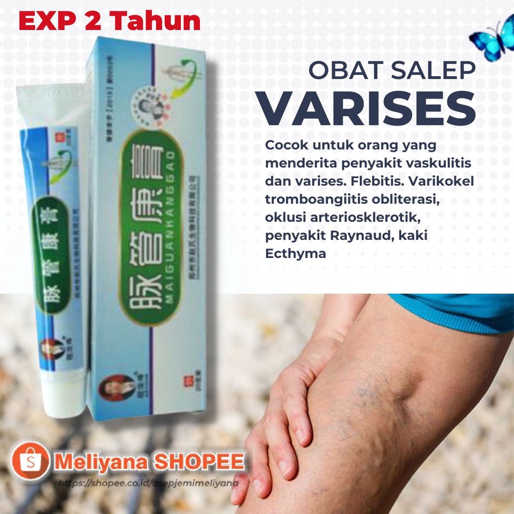 Salep Varises Herbal Ampuh Varicose Veins Treatment