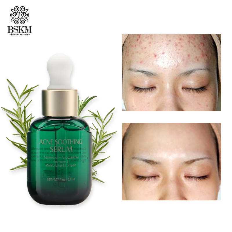 BSKM 23ml Acne Prone Treatment Serum Tea Tree Oil Long-lasting Repair Moisturizing Serum- Perawatan &amp; Penghilang Jerawat Wajah Skincare LB0062