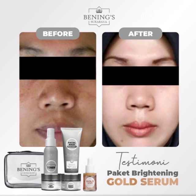 BENING'S PAKET BRIGHTENING | MENCERAHKAN DAN MENGATASI KULIT KUSAM