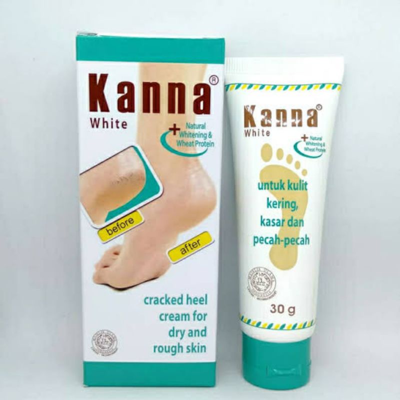 ORIGINAL KANNA WHITE 30 GRAM / FOOT LOTION KRIM KAKI KULIT KERING 30 G