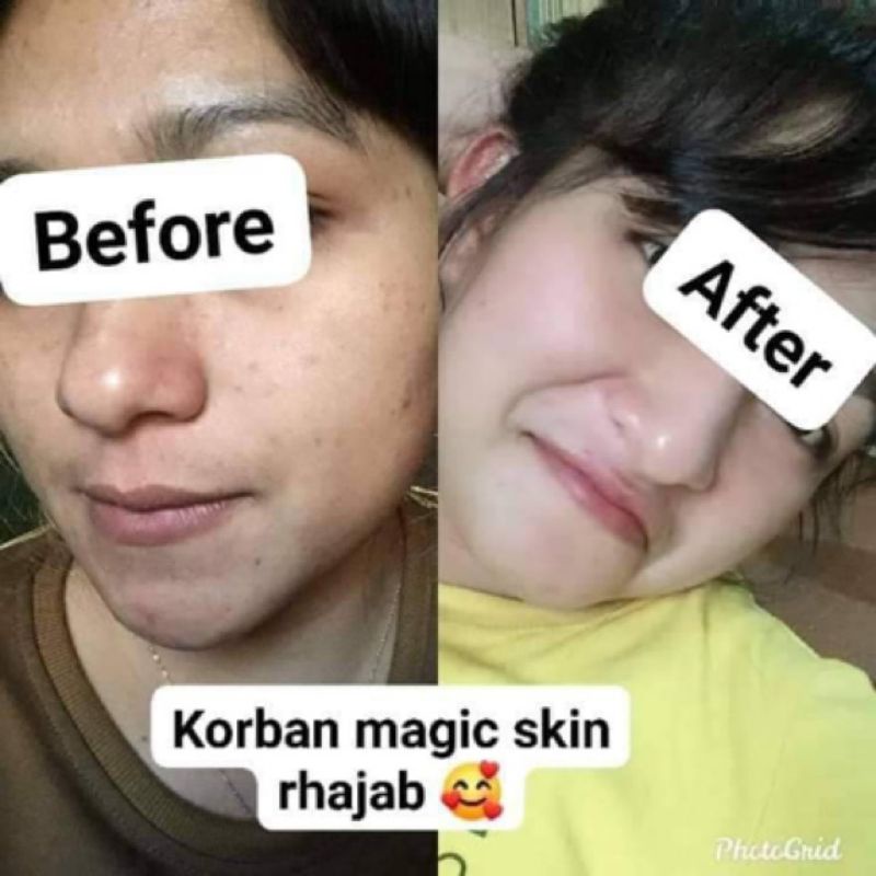 MAGIC SKIN BY RHAJAB BEAUTY ORIGINAL DISTRIBUTOR JAKARTA BARAT