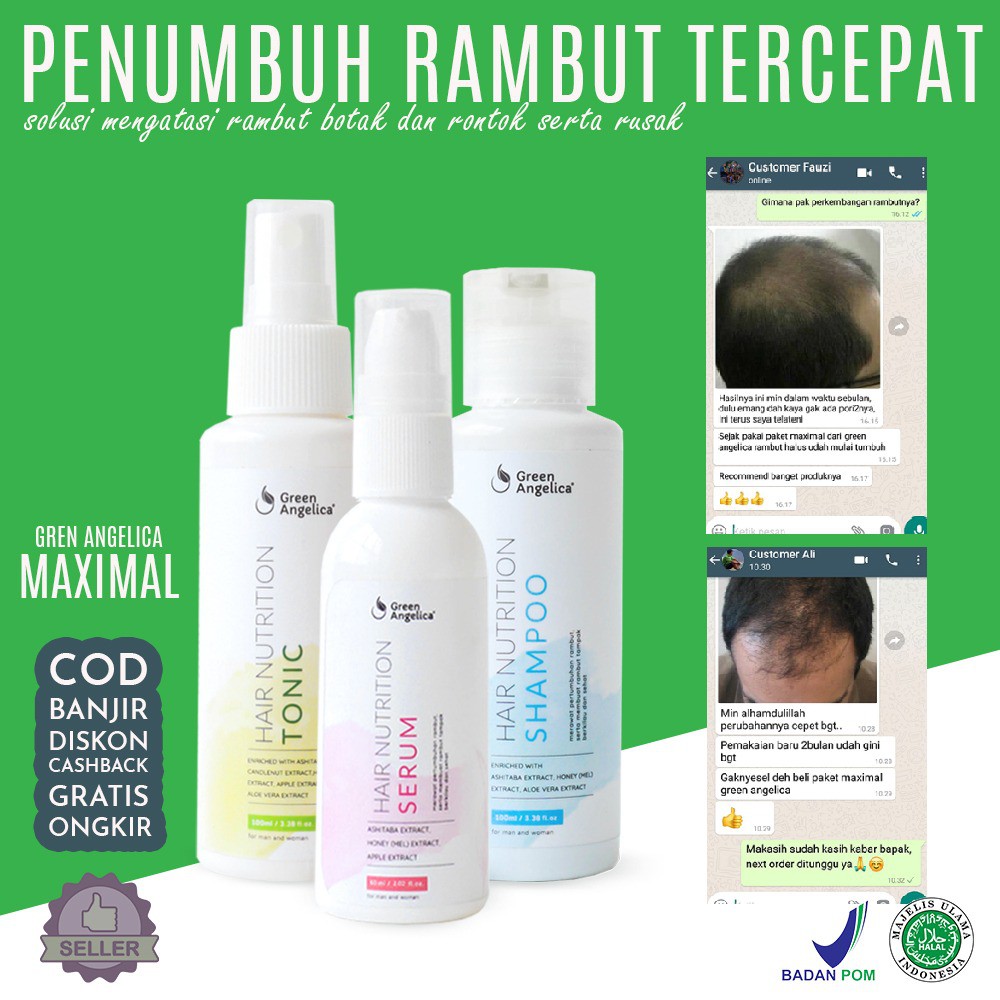 Penumbuh Rambut ALAMI dan PERMANEN Ampuh Mengatasi Kebotakan Green Angelica ORIGINAL Penumbuh Rambut