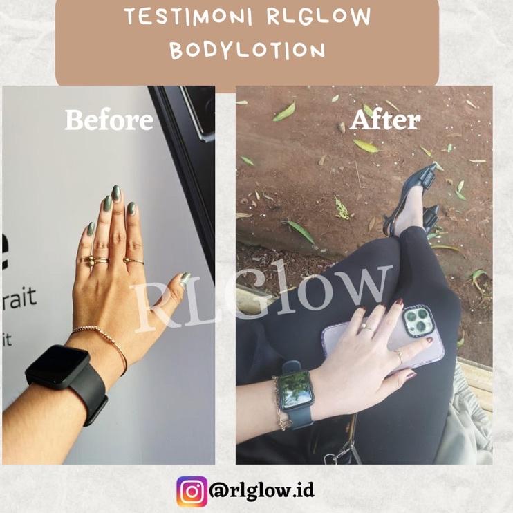 ⍐ RL GLOW BODY LOTION PEMUTIH BADAN AMPUH MEMUTIHKAN KULIT /MEMUDARKAN BEKAS LUKA / MEMUDARKAN STRET
