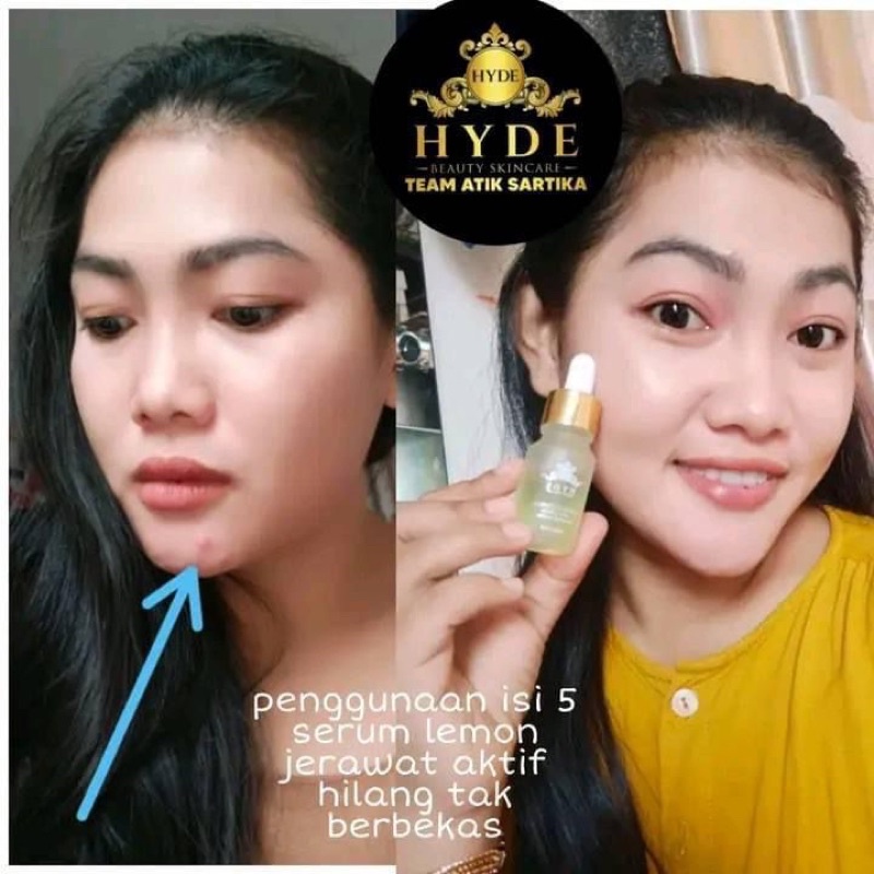 Hyde Beauty Skincare Paket Glowing isi 5