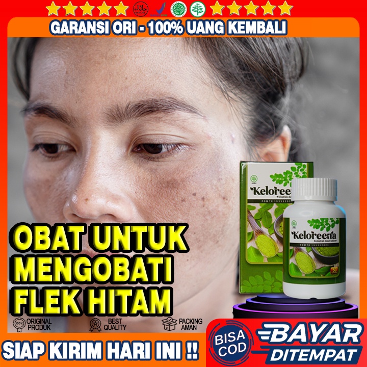 Obat Herbal Flek Hitam, Obat Penghilang Flek Hitam, Masker Penghilang Flek Hitam, Keloreena