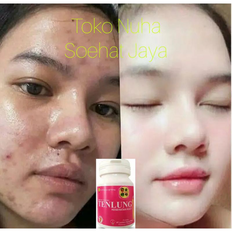 COD - Obat Herbal Pemutih Badan, Vitamin Pemutih Kulit Wanita, Obat Pemutih Badan, Pemutih Wajah Ter