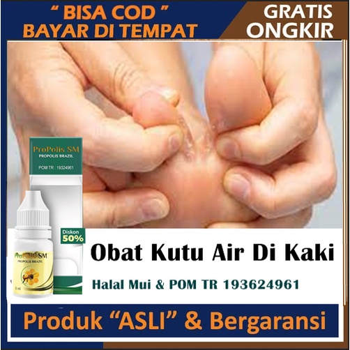 Obat Kutu Air Di Kaki, Obat Kutu Air Di Tangan, Obat Gatal Kutu Air Akibat Jamur, Penghilang - Penum