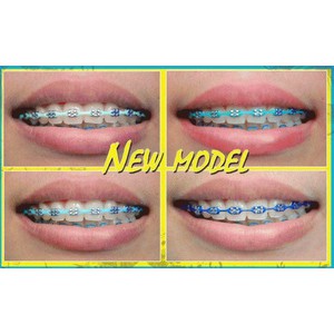 Behel Lepas Pasang Asli Atas / Bawah Power Chain