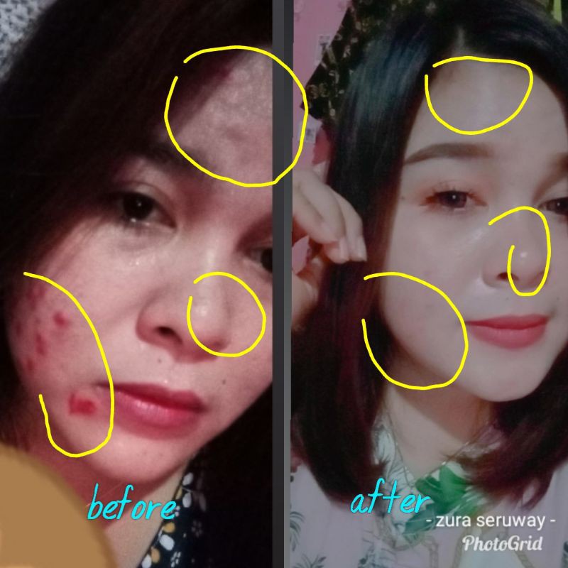 Zr.skincare original  /Cream kecantikan wajah paket biasa