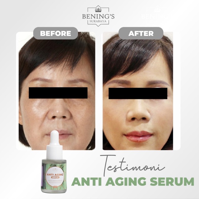 BENING'S SERUM ANTI AGING | UNTUK KERUTAN &amp; MENCERAHKAN | BPOM &amp; HALAL I FREE GIFT SIAP KIRIM SELURUH INDONESIA