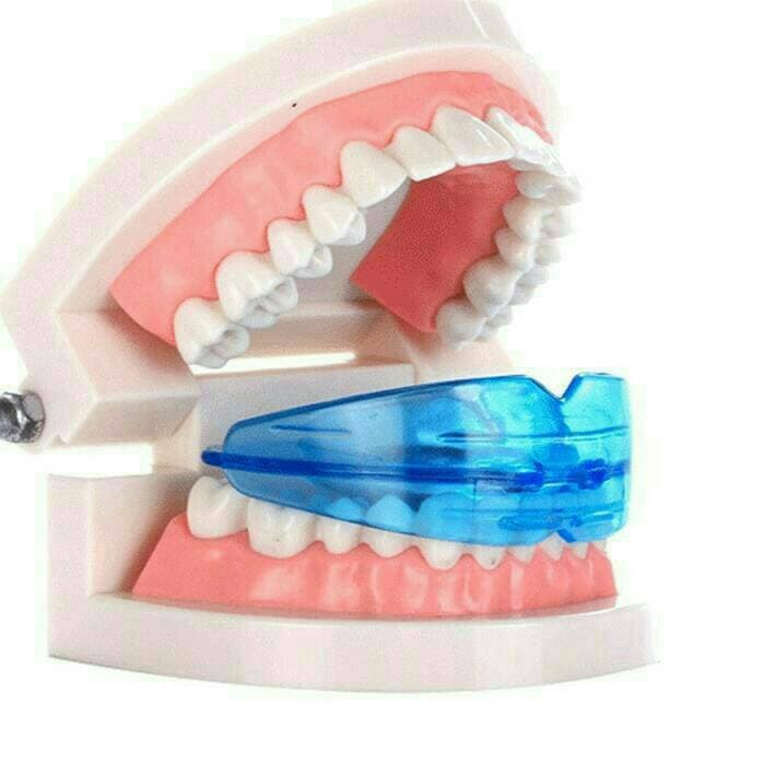 BEHEL PERATA PERAPAT GIGI BUKAN KAWAT BRACKET GIGI TEETH LEPAS PASANG PROMO