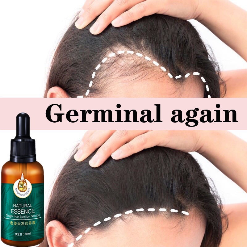 Minyak esensial perawatan rambut/ Anti-Hair Loss Serum/ Natural Essence Ginger Hair Tonic/ Toner Rambut Ekstrak Sari Jahe 30 ML