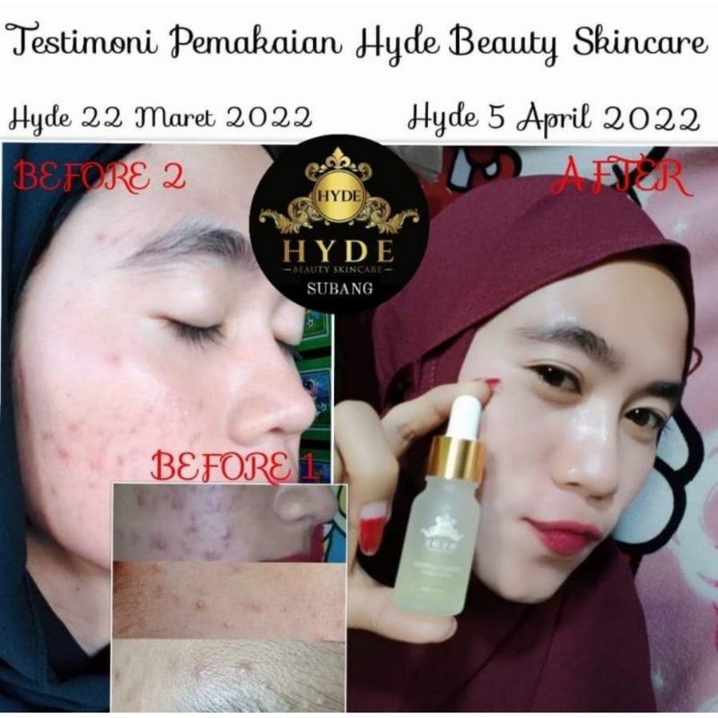 Hyde Beauty Skincare Bpom Perawatan Wajah Glowing Kecantikan Pelembab Wajah Sabun Mandi Cair Make Up Promo Murah Flash Sale