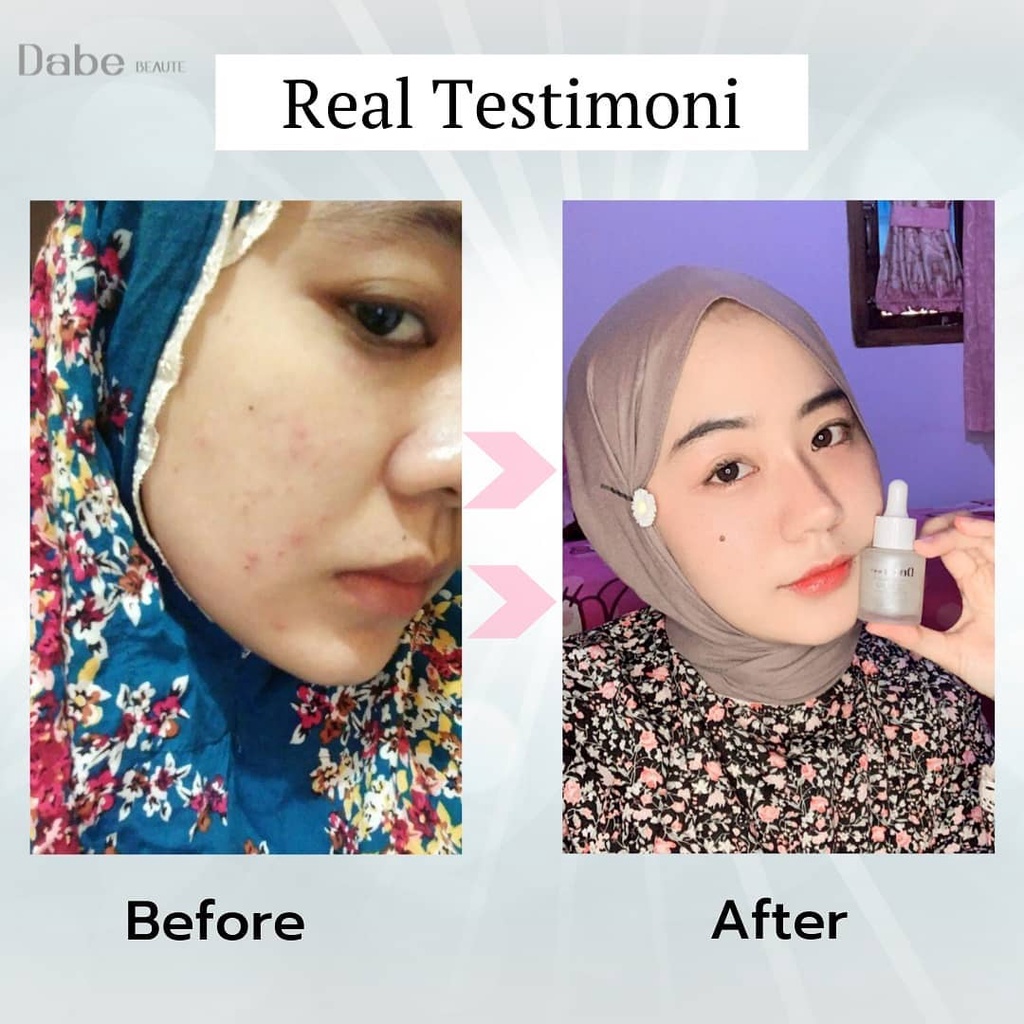 (FREE GIFT) DABE BEAUTE SKINCARE BPOM BY BELLA SHOFIE / PENCERAH WAJAH / CREAM WAJAH / ACNE / TONER / 100% ORIGINAL / SERUM /