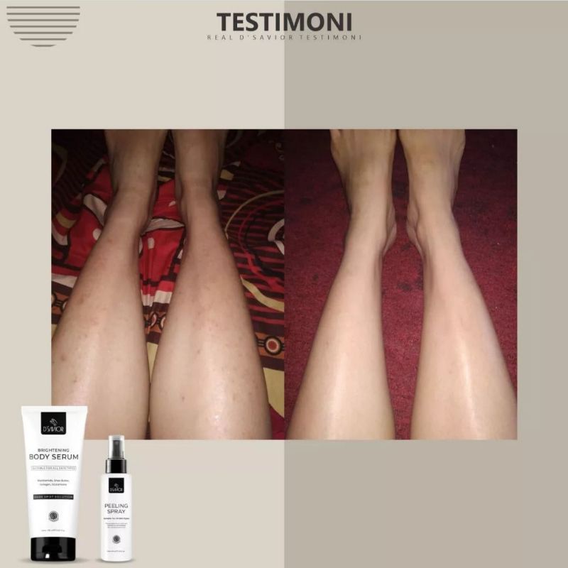 DSavior Body Whitening [Jaminan Original] Lotion Pencerah Badan Original BPOM D Savior Dark Spot Serum Lotion Pemutih Badan Ampuh Permanan Penghilang Bekas Luka Bpom