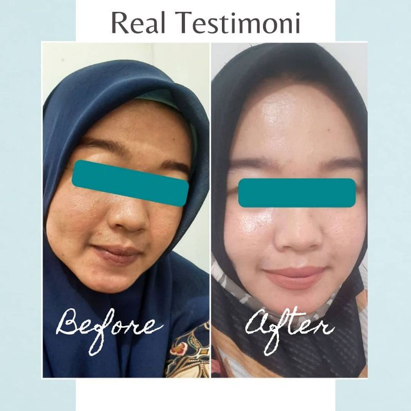 Dabe Beaute Skincare Original BPOM by Bella Shofie (free Gift)