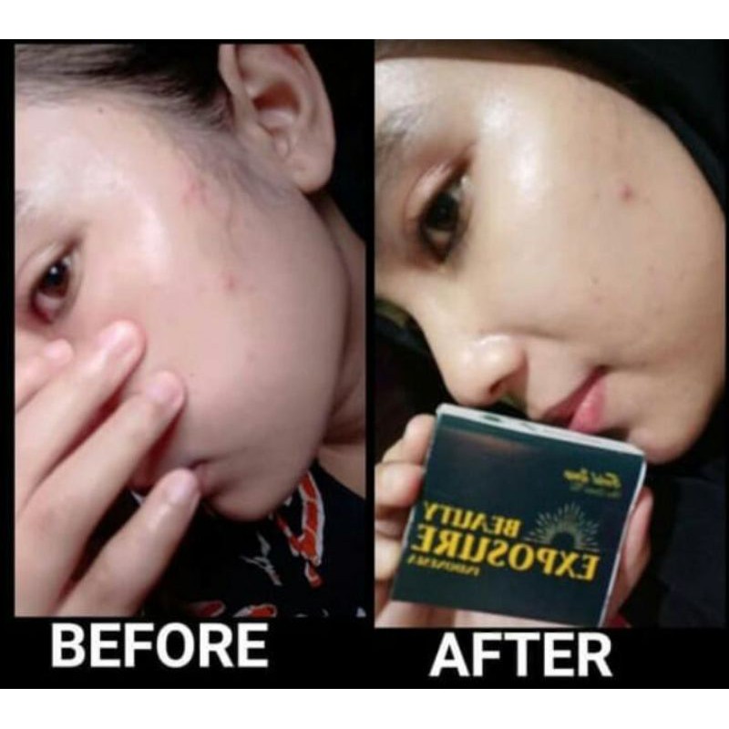 Sabun Bexindo/sabun kecantikan/Sabun wajah