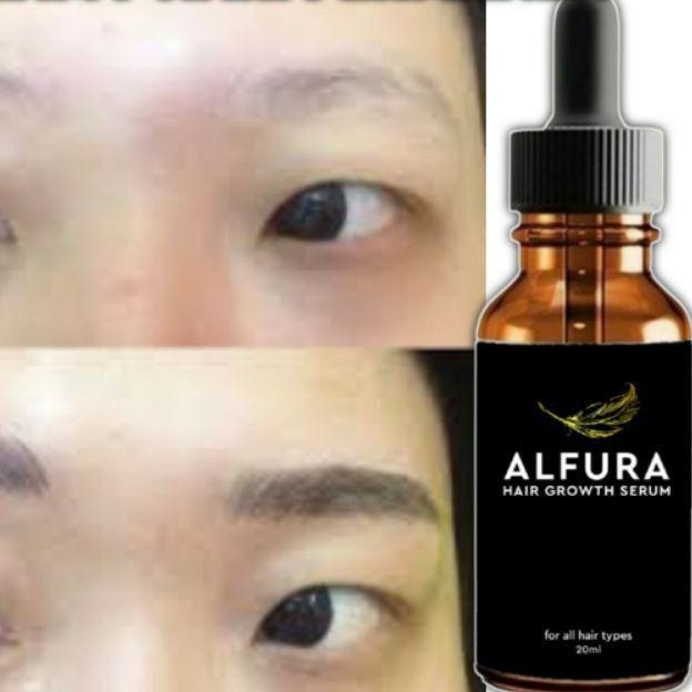 ○ [BISA ] TOP NO 1 SERUM PENUMBUH RAMBUT ALFURA ➪