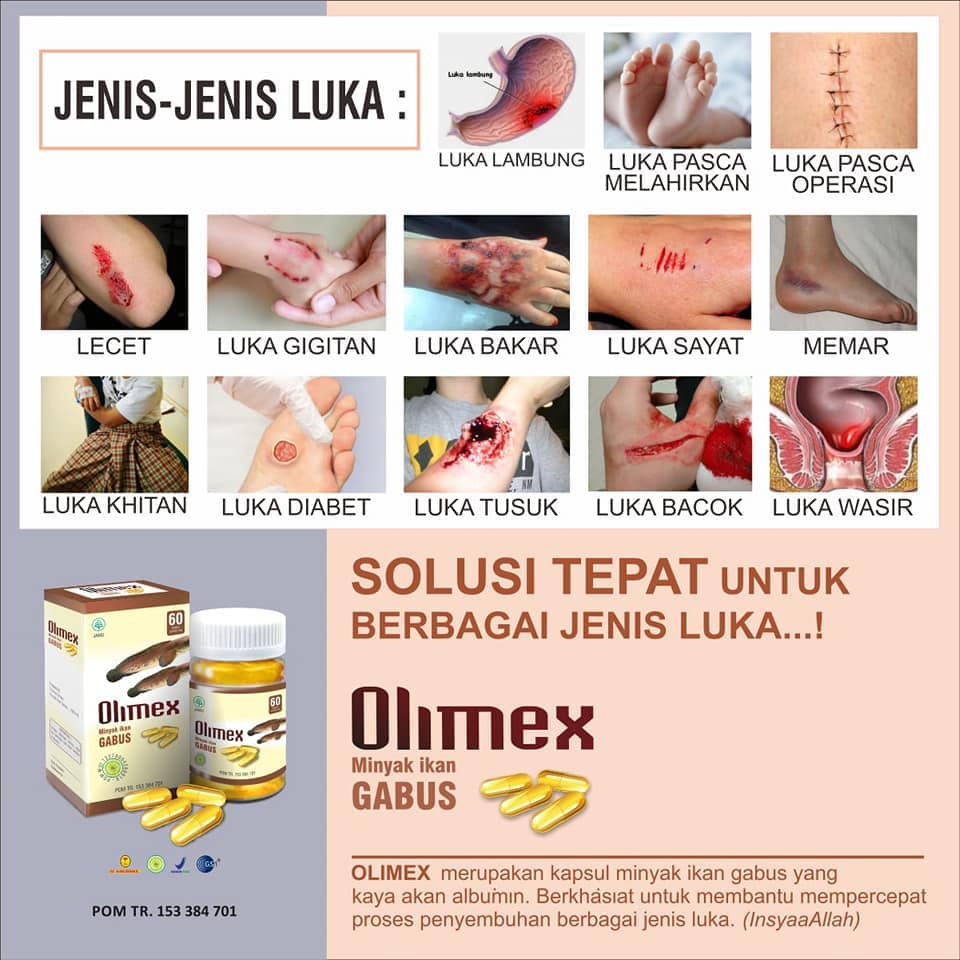 Kapsul Ekstrak Ikan Gabus Kutuk Olimex - Kapsul Pasca Operasi ASLI 100% - Ekstrak Albumin Albusmin Sari Kutuk Ikan Gabus Luka 5x Lebih Cepat Kering Asi Booster - olimax