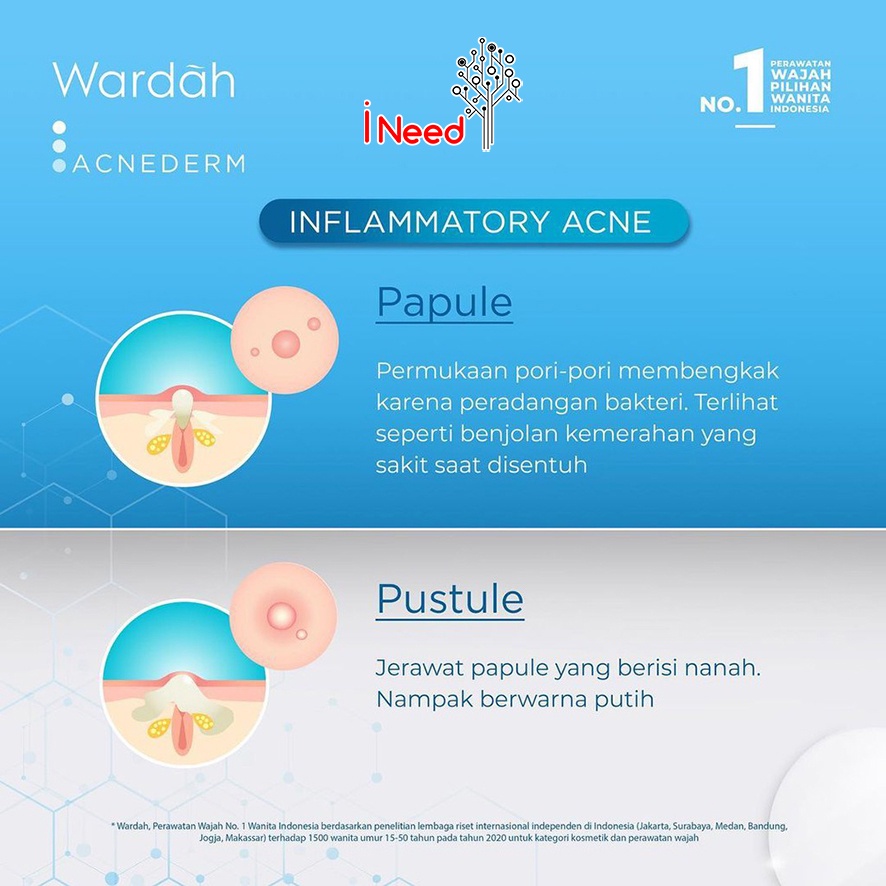 (INEED) WARDAH Acnederm Series | WARDAH ACNEDERM Mengatasi Jerawat Dan Bekas Jerawat - WARDAH ACNE DERM