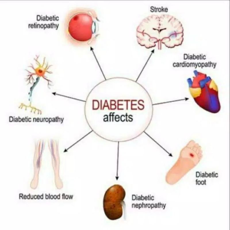 GLUCOACTIVE asli 100% original obat diabetes dan kencing manis