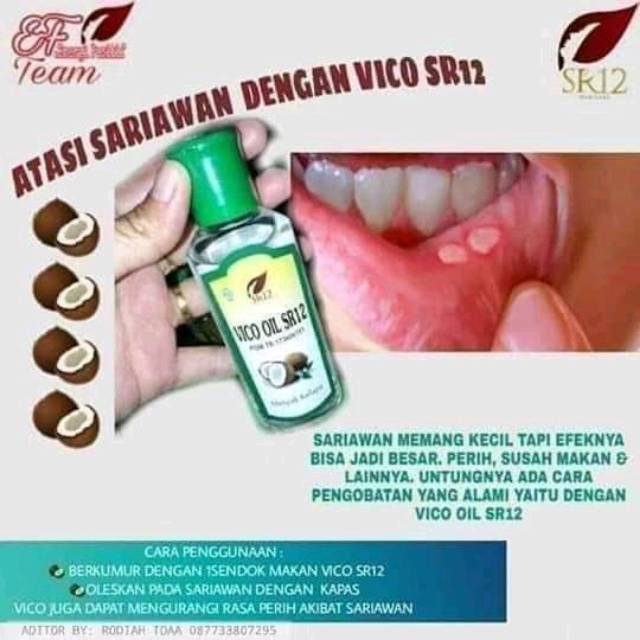 Sr12 Obat Sariawan Sakit Gigi Vco Sr12 Herbal Shopee Indonesia