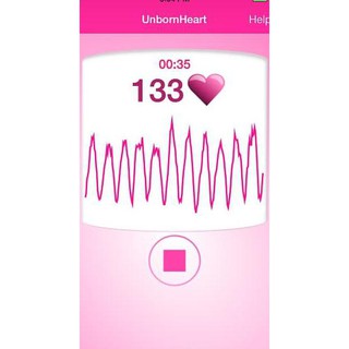 unbornheart fetal doppler