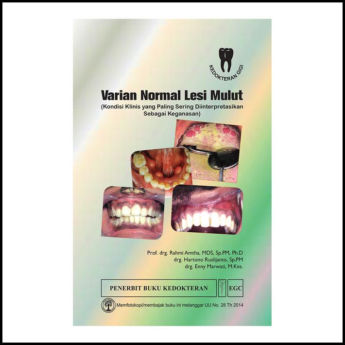 Storewijaya | Egc Varian Normal Lesi Mulut