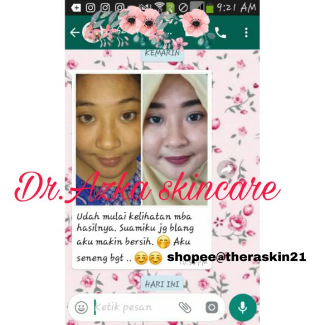 PAKET WHITENING EXPRESS DR AZKA (ISI 4)