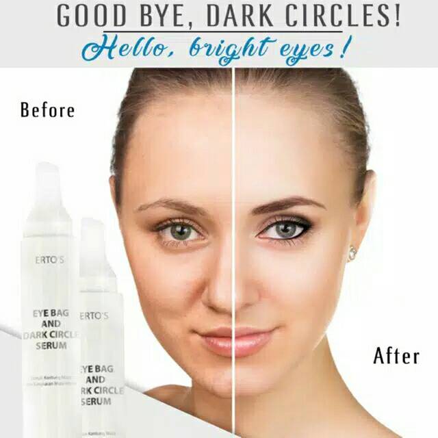 Ertos Serum Penghilang Kantung Mata Dan Mata Panda Erto S Eye Bag And Dark Circle Indonesia