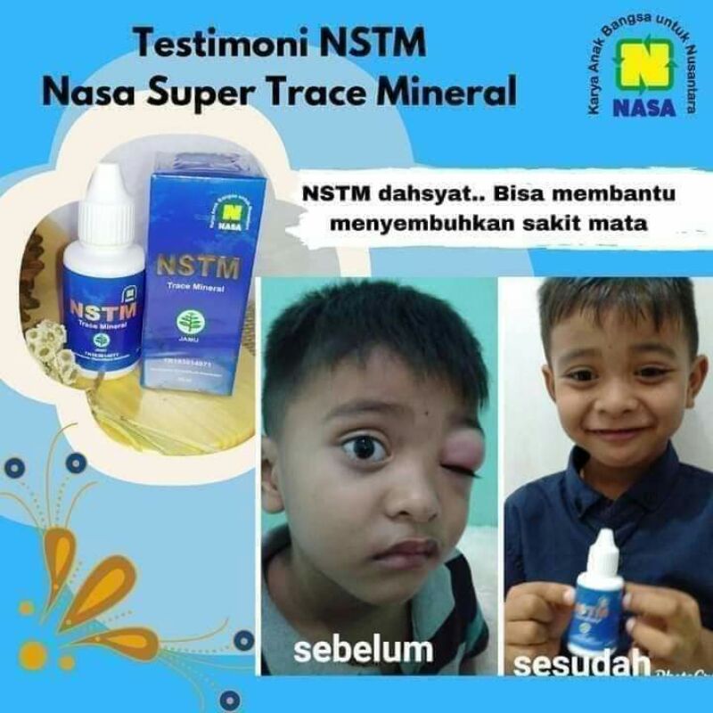 NSTM HERBAL SEMBUHKAN MATA BENGKAK FREE GELAS RIMBANG MATA
