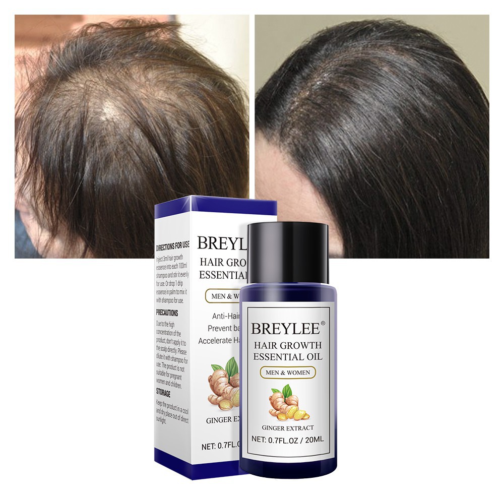 BREYLEE Hair Growth Essential Oil Fast Powerful - Breylee Minyak Penumbuh Rambut Cepat