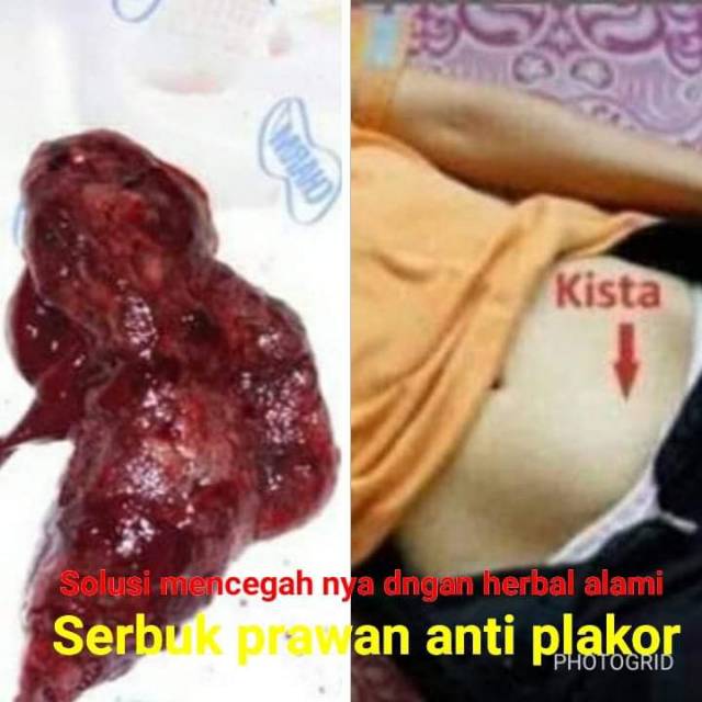 serbuk perawan anti pelakor