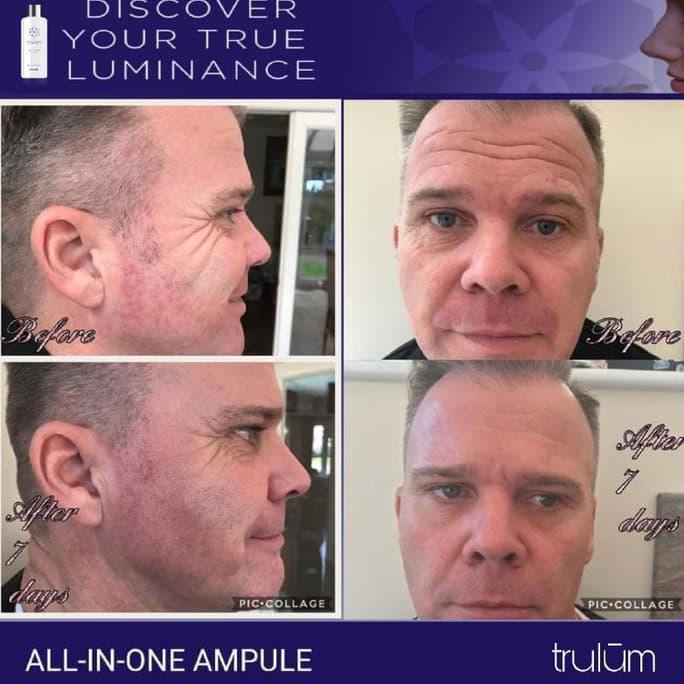 Krim Crem Pemutih Wajah Pria Wanita | Skincare Anti Aging Paling Ampuh