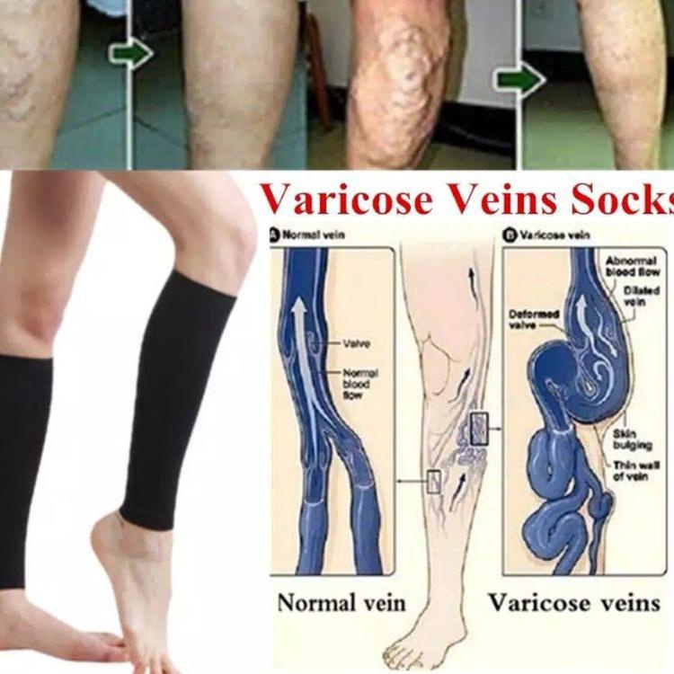 ❤  4.4  korset lengan pelangsing lengan korset lengan magnetic korset paha korset betis korset kaki