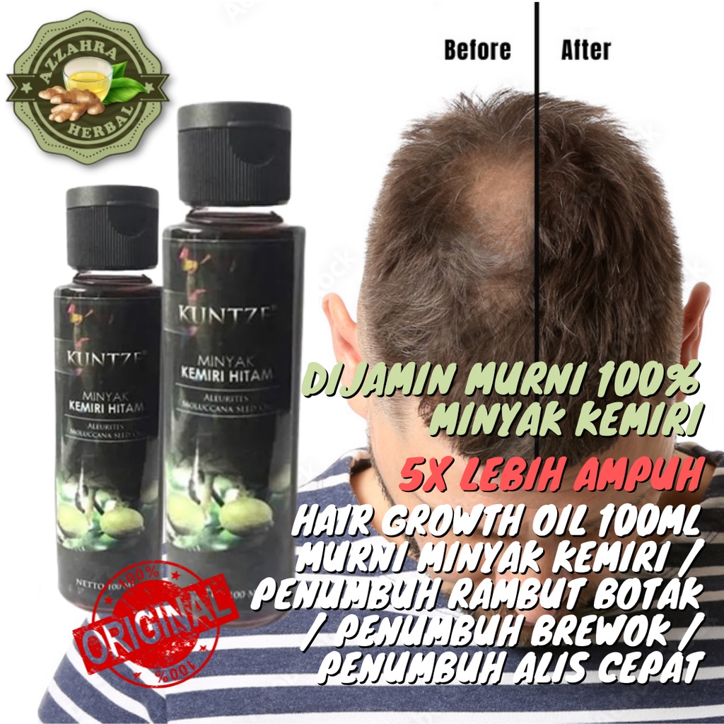 100ml Minyak Kemiri Hitam Murni 𝐎𝐑𝐈𝐆𝐈𝐍𝐀𝐋 / Penumbuh Rambut Botak Rontok / Penumbuh Brewok KUNTZE