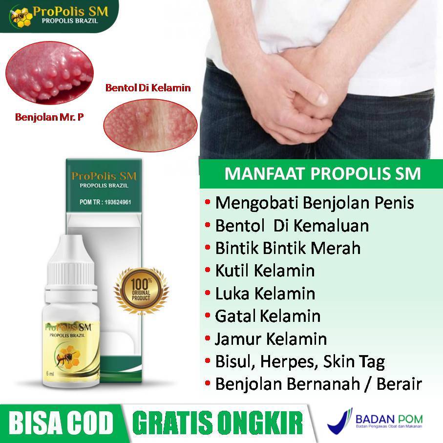 Obat Benjolan Di Penis, Bentol Di Kelamin, Luka Kelamin, Bintik Merah, Kutil Kelamin, Jamur Kelamin,