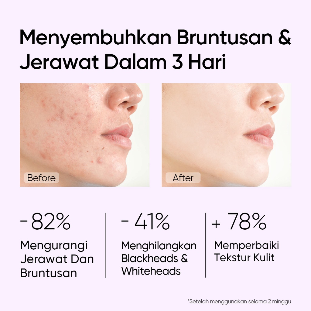 【Skintific Outlet Official】SKINTIFIC 3pcs Set Blackhead Removal | 2% AHA 2%BHA 1% PHA Exfoliating Toner 80ml + 2% Salicylic Acid Anti Acne Serum 20ml + Mugwort Anti Pores &amp; Acne Clay Mask 55g Masker Wajah