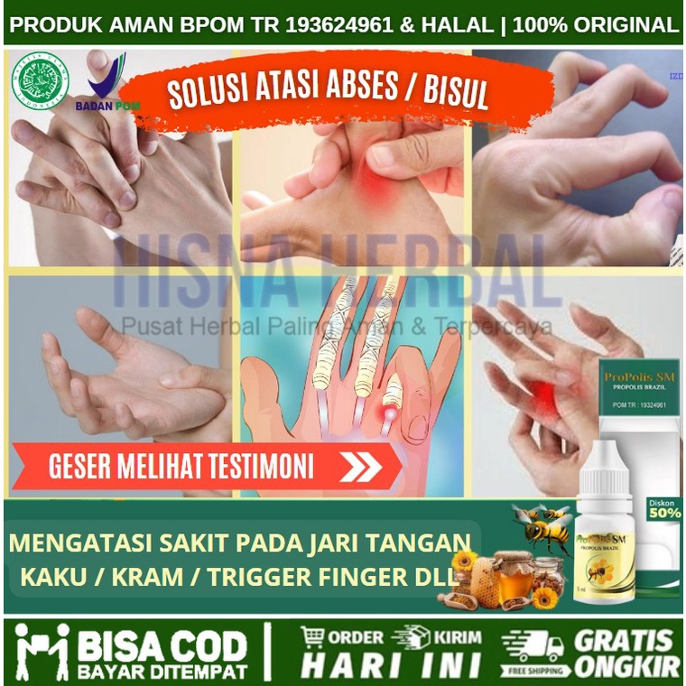 Obat Trigger Finger, Jari Patah, Obat Jari Tangan Kaku, Kram Otot, Kesemutan, Kebas, Sakit Pinggang,