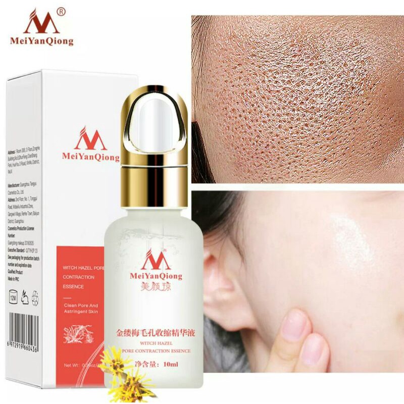 MeiYanQiong hamamelis pori menyusut esensi pori exfoliator