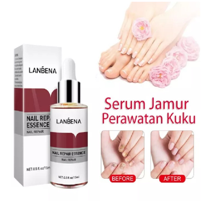 Lanbena Obat Kuku Serum Jamur Kuku Perbaikan Kuku Rusak 12ml