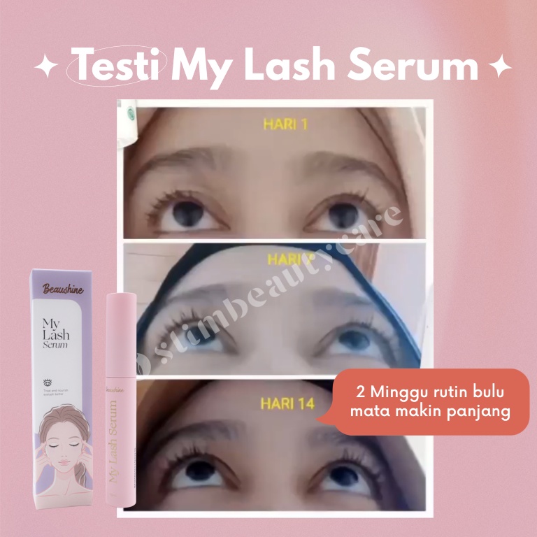 MY LASH SERUM (EYELASH/BULU MATA SERUM, MENEBALKAN BULU MATA &amp; ALIS)