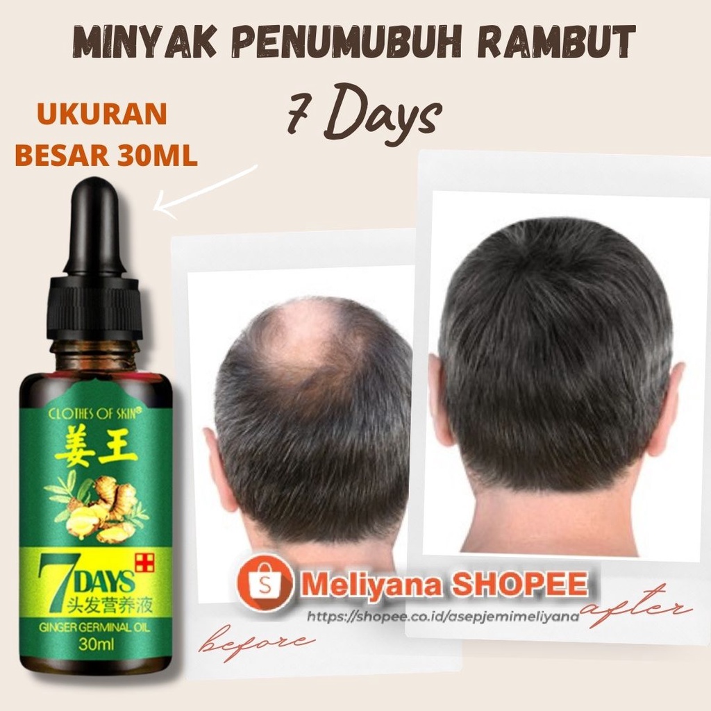 7 Days Clothes Of Skin Ginger Germinal Oil Minyak Penumbuh Rambut