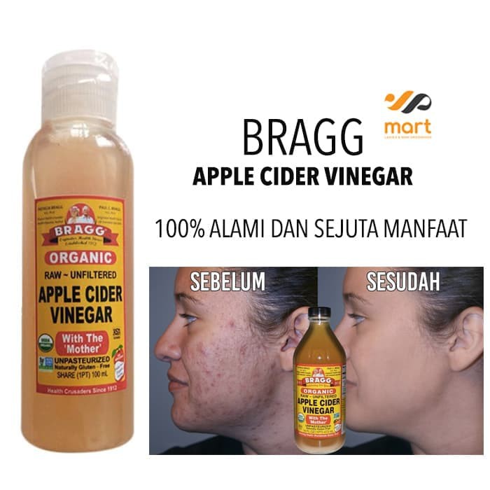 Toner Cuka Apel Share In Bottle Bragg Apple Toner Jerawat Bragg Herbal Indonesia