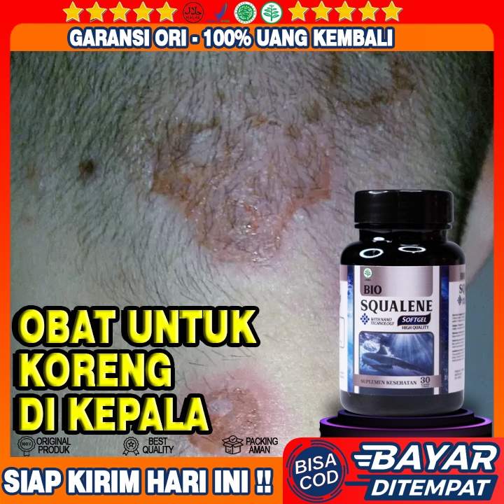 Obat Koreng Kepala - Obat Koreng Bernanah - Obat Luka Koreng Di Kepala - Obat Herbal Koreng - Budug 